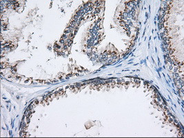 MOBKL1A Antibody in Immunohistochemistry (Paraffin) (IHC (P))