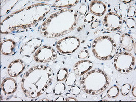 MOBKL1A Antibody in Immunohistochemistry (Paraffin) (IHC (P))