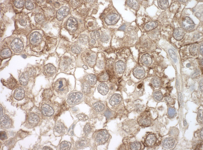 MOV10 Antibody in Immunohistochemistry (IHC)