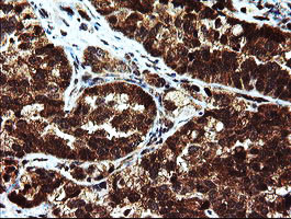 MPI Antibody in Immunohistochemistry (Paraffin) (IHC (P))