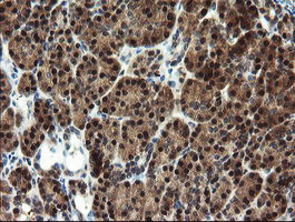 MPI Antibody in Immunohistochemistry (Paraffin) (IHC (P))