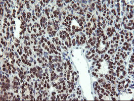 MPI Antibody in Immunohistochemistry (Paraffin) (IHC (P))