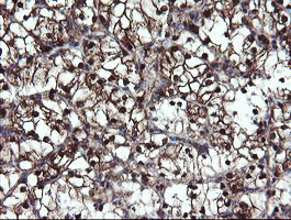 MPI Antibody in Immunohistochemistry (Paraffin) (IHC (P))