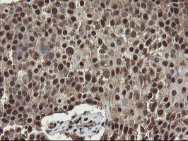 MPI Antibody in Immunohistochemistry (Paraffin) (IHC (P))