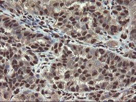 MPI Antibody in Immunohistochemistry (Paraffin) (IHC (P))