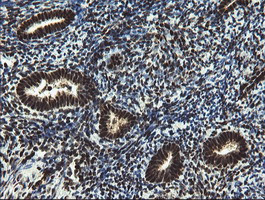 MPI Antibody in Immunohistochemistry (Paraffin) (IHC (P))