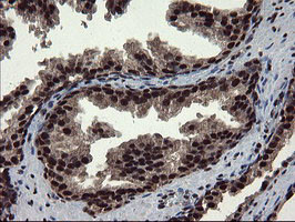 MPI Antibody in Immunohistochemistry (Paraffin) (IHC (P))