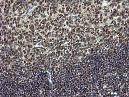 MPI Antibody in Immunohistochemistry (Paraffin) (IHC (P))