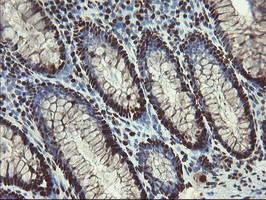 MPI Antibody in Immunohistochemistry (Paraffin) (IHC (P))