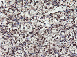 MPI Antibody in Immunohistochemistry (Paraffin) (IHC (P))