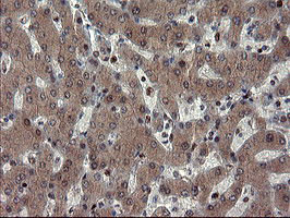 MPI Antibody in Immunohistochemistry (Paraffin) (IHC (P))