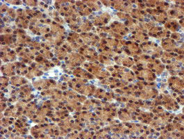 MPI Antibody in Immunohistochemistry (Paraffin) (IHC (P))