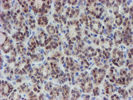 MPI Antibody in Immunohistochemistry (Paraffin) (IHC (P))