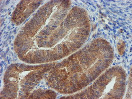 MPI Antibody in Immunohistochemistry (Paraffin) (IHC (P))