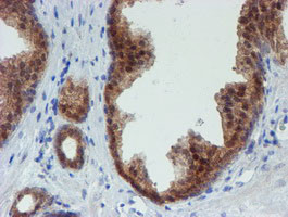 MPI Antibody in Immunohistochemistry (Paraffin) (IHC (P))