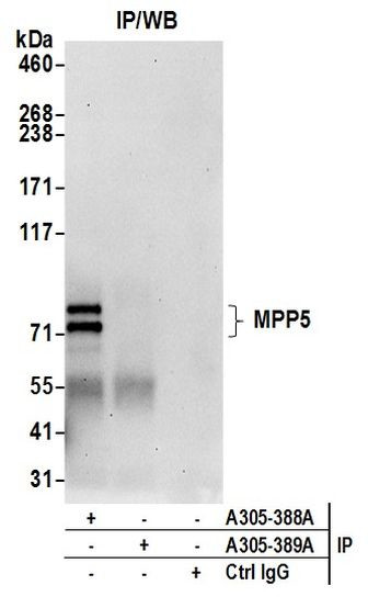 MPP5/Pals1 Antibody in Immunoprecipitation (IP)