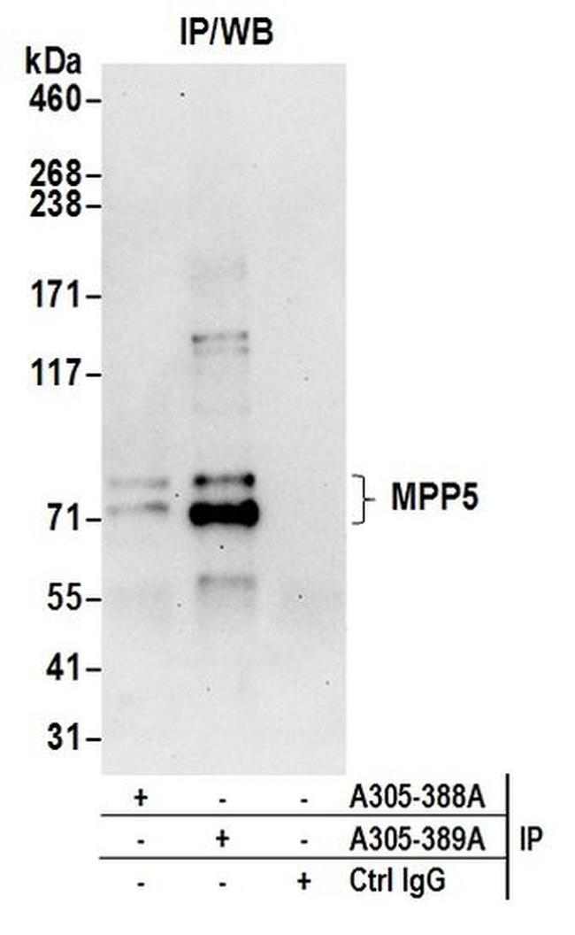 MPP5/Pals1 Antibody in Western Blot (WB)