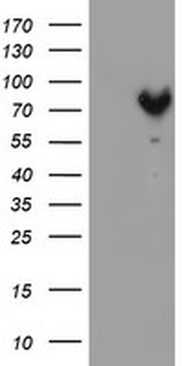 MPP5 Antibody in Western Blot (WB)