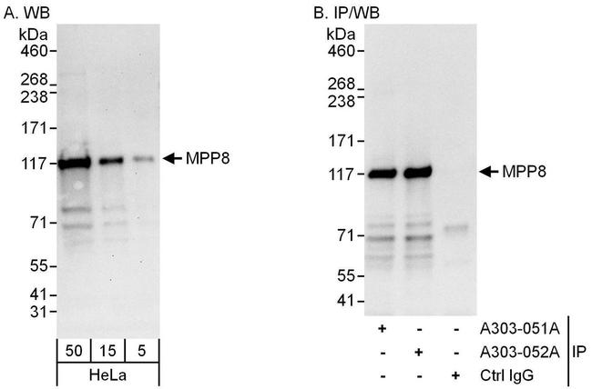 MPP8 Antibody in Western Blot (WB)