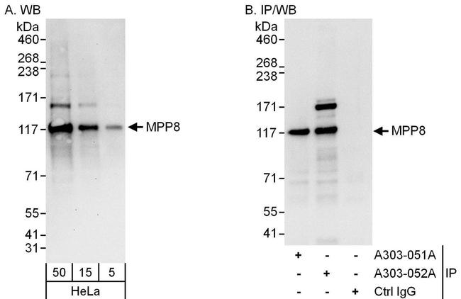 MPP8 Antibody in Western Blot (WB)