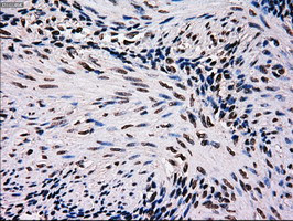 MRI1 Antibody in Immunohistochemistry (Paraffin) (IHC (P))