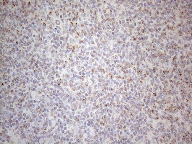 MRPL10 Antibody in Immunohistochemistry (Paraffin) (IHC (P))