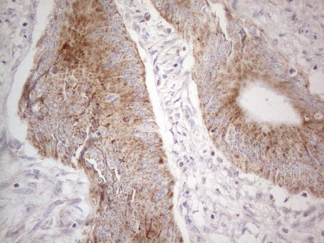 MRPL10 Antibody in Immunohistochemistry (Paraffin) (IHC (P))