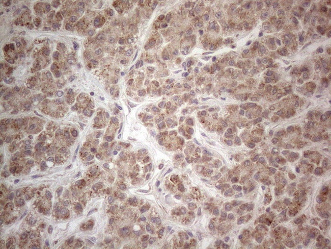 MRPL10 Antibody in Immunohistochemistry (Paraffin) (IHC (P))