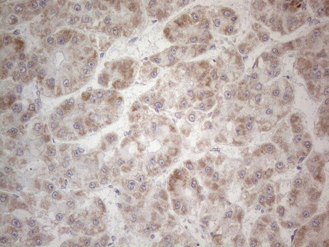 MRPL10 Antibody in Immunohistochemistry (Paraffin) (IHC (P))