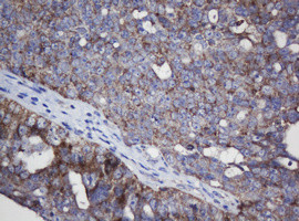 MRPL11 Antibody in Immunohistochemistry (Paraffin) (IHC (P))