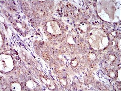 MRPL42 Antibody in Immunohistochemistry (Paraffin) (IHC (P))