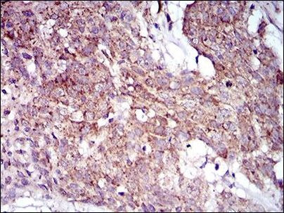 MRPL42 Antibody in Immunohistochemistry (Paraffin) (IHC (P))