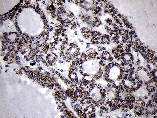 MRPL44 Antibody in Immunohistochemistry (Paraffin) (IHC (P))