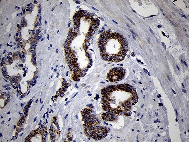 MRPL44 Antibody in Immunohistochemistry (Paraffin) (IHC (P))