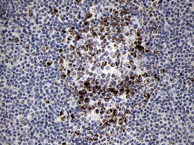 MRPL44 Antibody in Immunohistochemistry (Paraffin) (IHC (P))