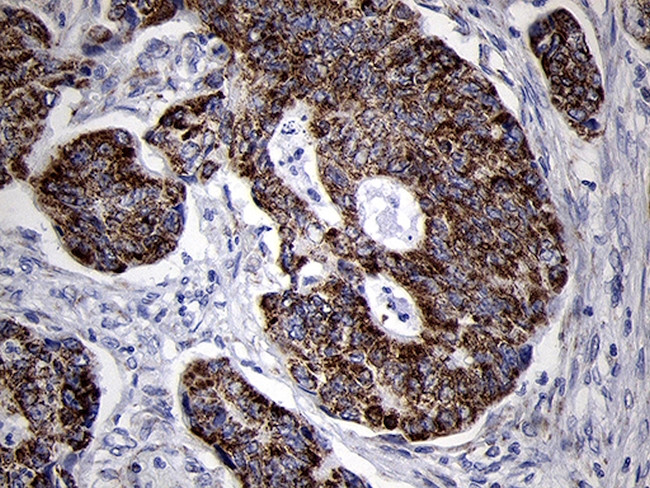 MRPL44 Antibody in Immunohistochemistry (Paraffin) (IHC (P))