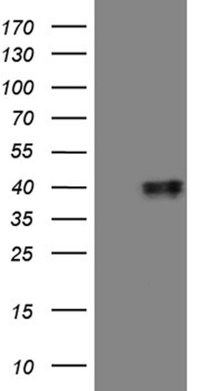 MRPL44 Antibody in Western Blot (WB)