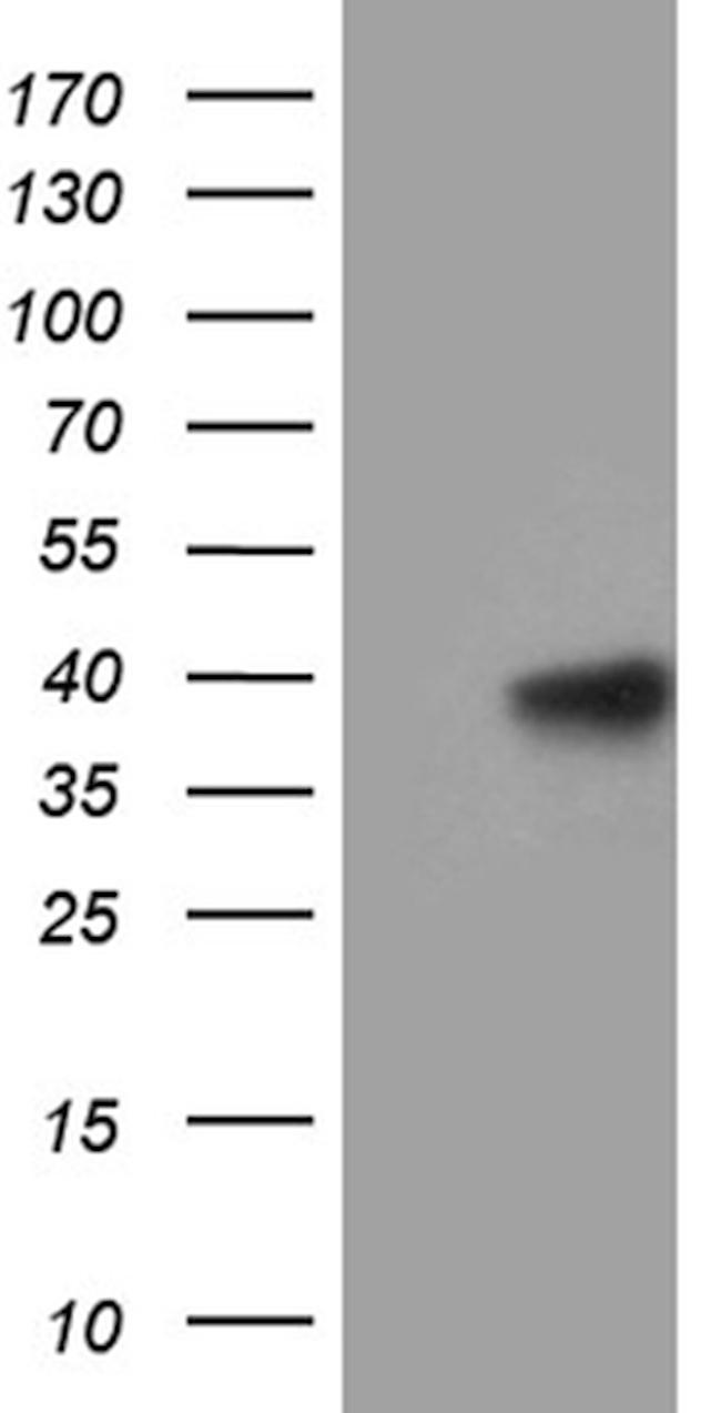 MRPL44 Antibody in Western Blot (WB)