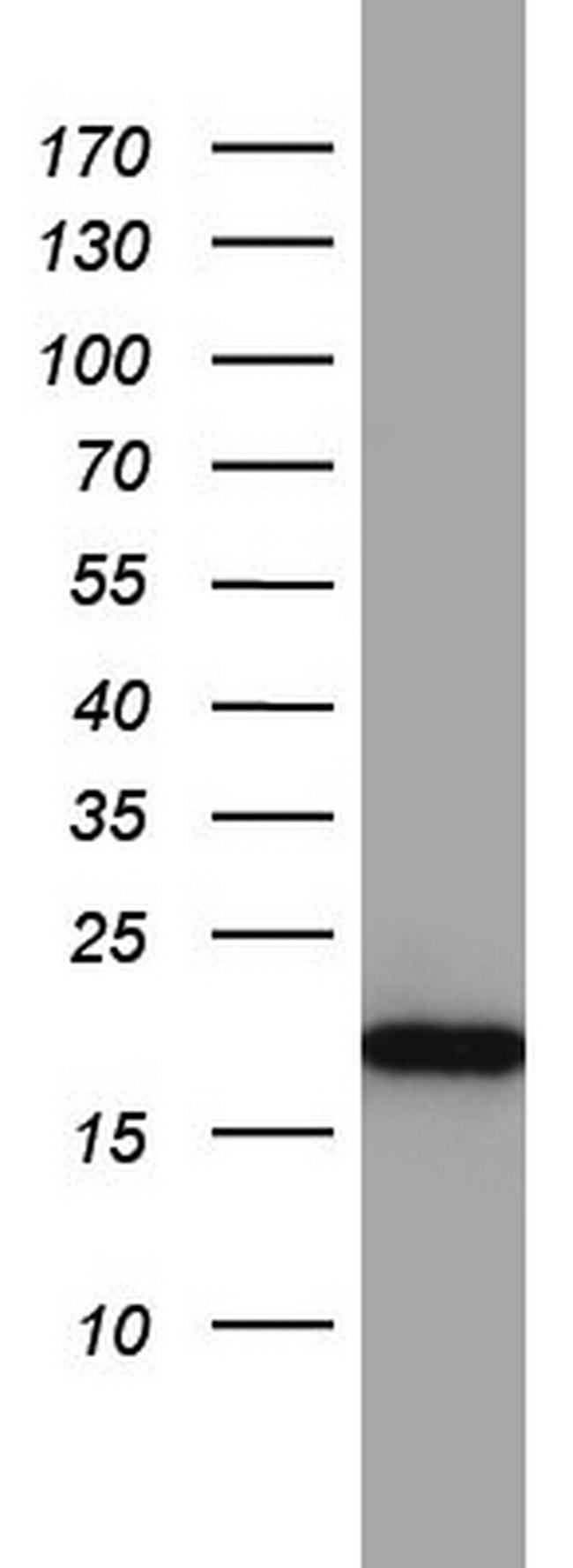 MRPS11 Antibody in Western Blot (WB)