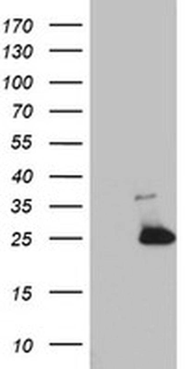 MRPS11 Antibody in Western Blot (WB)