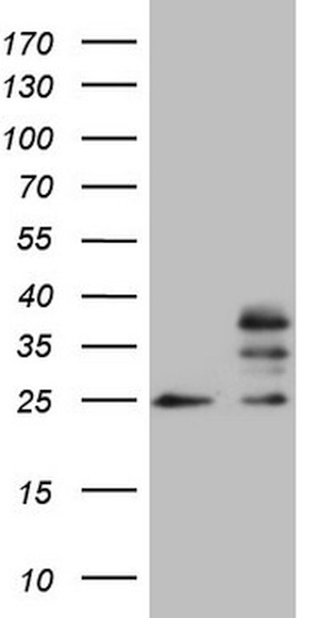 MRPS15 Antibody in Western Blot (WB)