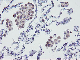 MRPS27 Antibody in Immunohistochemistry (Paraffin) (IHC (P))