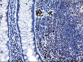 MRPS27 Antibody in Immunohistochemistry (Paraffin) (IHC (P))