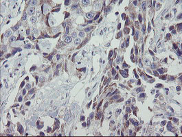 MRPS27 Antibody in Immunohistochemistry (Paraffin) (IHC (P))