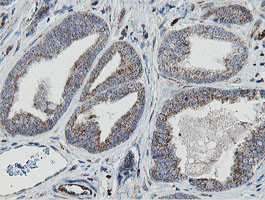 MRPS27 Antibody in Immunohistochemistry (Paraffin) (IHC (P))