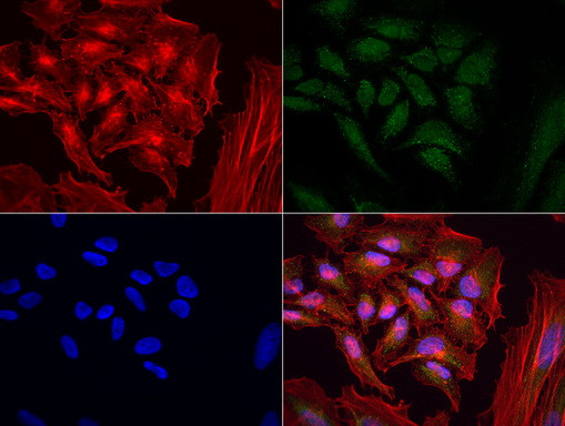 MRPS34 Antibody in Immunocytochemistry (ICC/IF)