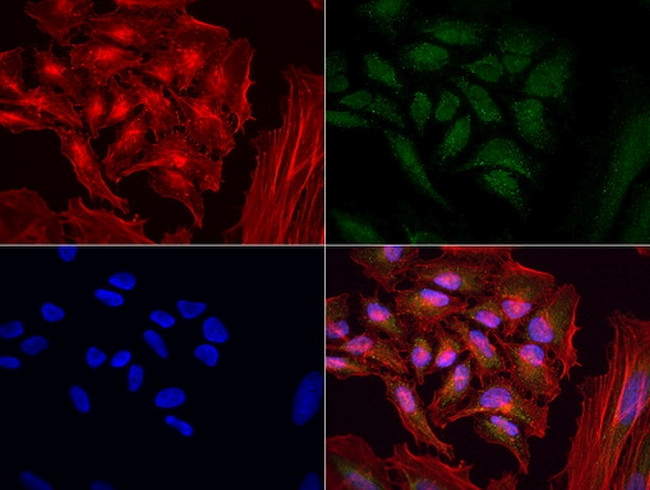 MRPS34 Antibody in Immunocytochemistry (ICC/IF)