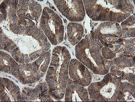 MRPS34 Antibody in Immunohistochemistry (Paraffin) (IHC (P))