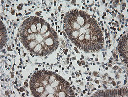 MRPS34 Antibody in Immunohistochemistry (Paraffin) (IHC (P))