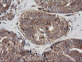 MRPS34 Antibody in Immunohistochemistry (Paraffin) (IHC (P))